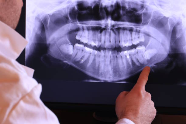 Best Emergency Dental Extractions in Fruitland, NC